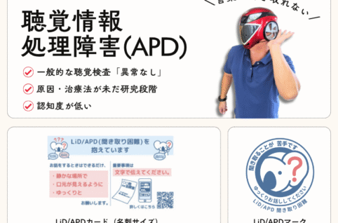 APD/LiDとは？